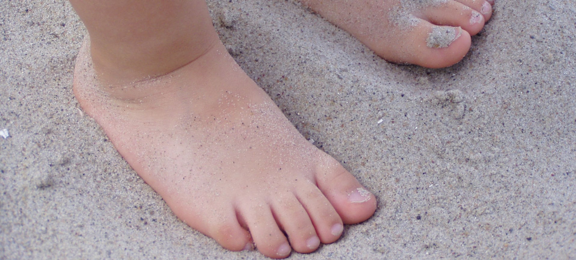 what is flat feet